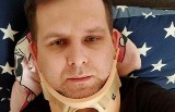 Ucierpiał w wypadku spowodowanym przez kierowcę z aplikacji. Mateusz Jarosz z Kielc zmaga się z powrotem do zdrowia. Możemy pomóc