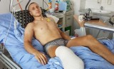 Bartłomiej Bertolin stracił nogę w wyniku wypadku na kopalni. Trwa zbiórka na rehabilitację i zakup protezy