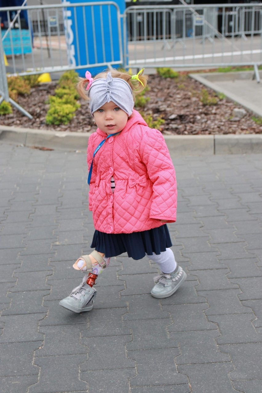 Nóżka trzyletniej Milenki potrzebuje operacji. Licealistki z Tarnobrzega prowadzą zbiórkę dla małej mieszkanki Stalowej Woli
