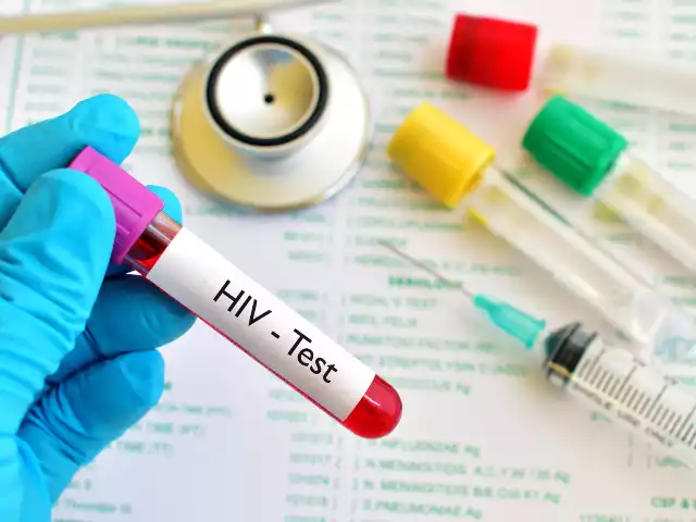 Badanie na obecność wirusa HIV jest zalecane wszystkim osobom, które uprawiały przypadkowy seks bez zabezpieczenia. Test na HIV można wykonać bezpłatnie i anonimowo w punkcie konsultacyjno-diagnostycznym, który znajduje się niemal w każdym większym mieście wojewódzkim.