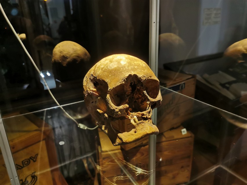Zrekonstruowano twarz szczątków odnalezionych z Chrzanowie
