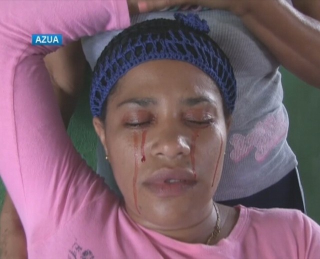 Kobieta z Dominikany płacze "krwawymi łzami". Lekarze są bezradni