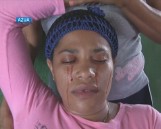 Kobieta z Dominikany płacze "krwawymi łzami". Lekarze są bezradni [wideo]