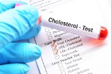 Masz takie objawy? Pora na sprawdzenie poziom cholesterolu. Nie lekceważ: bólu nóg, zmęczenia i żółtych grudek na skórze