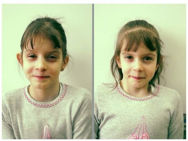 Daria (po lewej) i Olga Kołacz mają już 10 lat. Wciąż są pod opieką lekarzy.