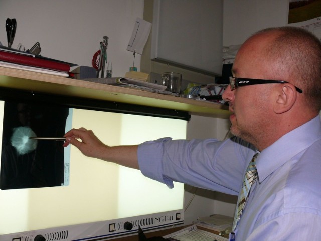 Lekarz specjalista radiodiagnostyki Krzysztof Antonowicz przy zdjęciu mammograficznym.