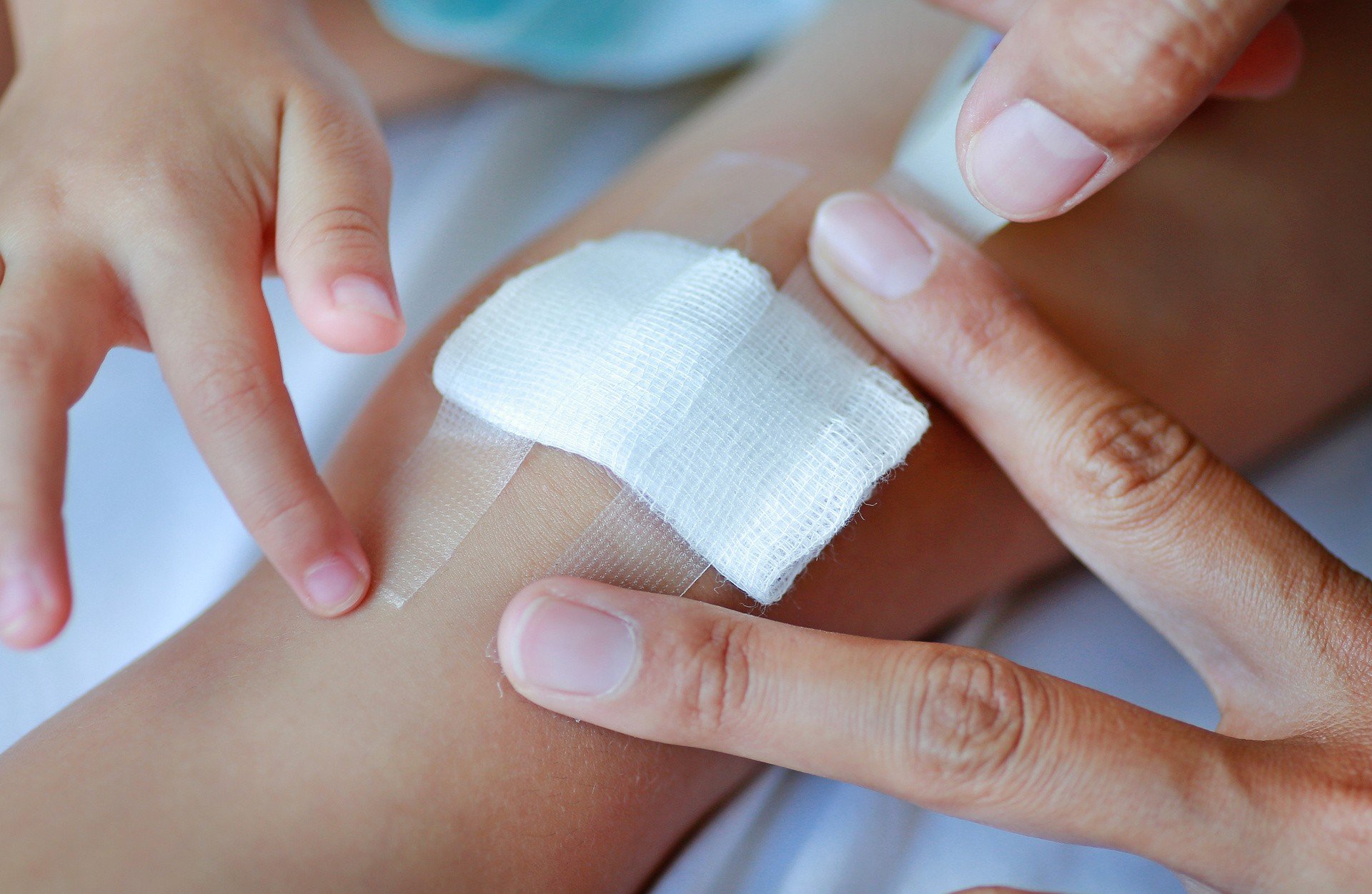 Domowe sposoby na skaleczenia i rany. Jak wygląda zakażenie rany i jak mu  zapobiec, gdy nie mamy pod ręką środków odkażających? | Strona Zdrowia