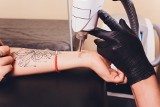 Na czym polega laserowe usuwanie tatuażu? Sprawdź efekty i ceny zabiegów. Czy da się całkowicie usunąć tatuaż lub makijaż permanentny?