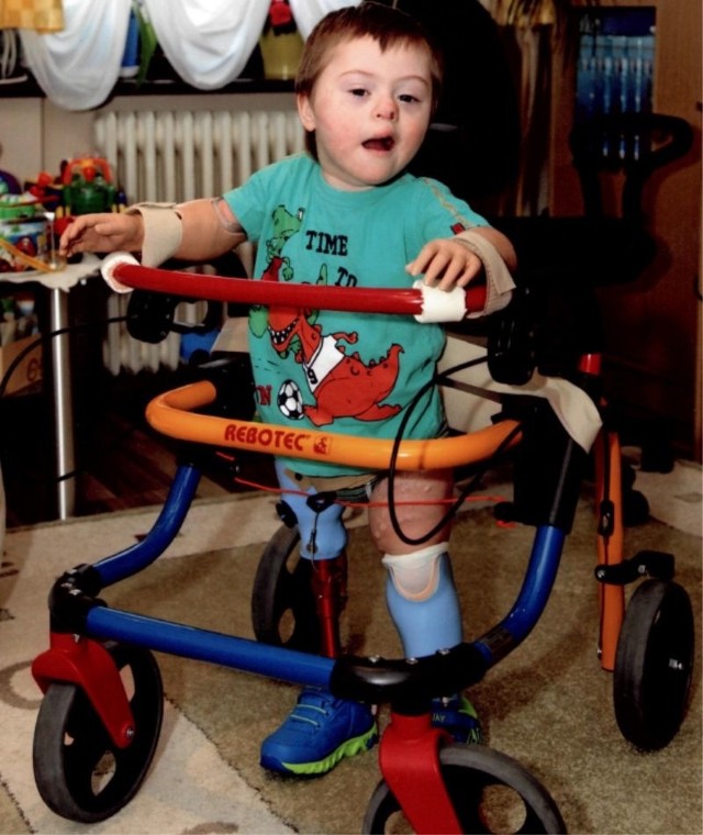 Bartek Kurhofer ma już prawie 4,5 roku. Dzięki zebranym nakrętkom można będzie kupić chłopczykowi nowe protezy.