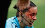 Sędzia zalana krwią. Asystent arbitra zderzyła się z kamerą telewizyjną i rozcięła głowę podczas meczu LaLiga Betis – Athletic Bilbao