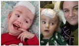 29 operacji główki dwuletniego Szymonka, setki nieprzespanych nocy, hektolitry wylanych łez