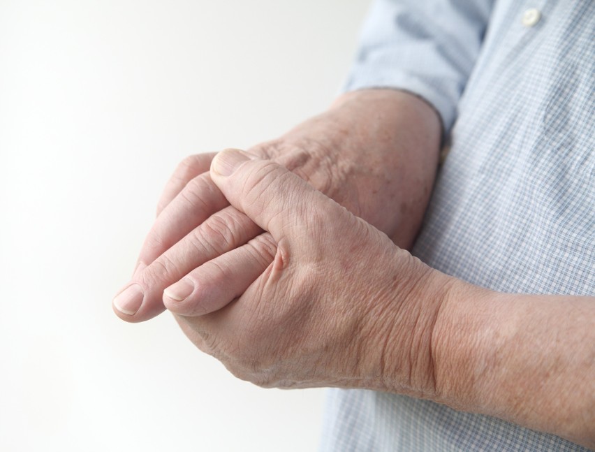 Reumatoidalne zapalenie stawów często dotyczy dłoni,...