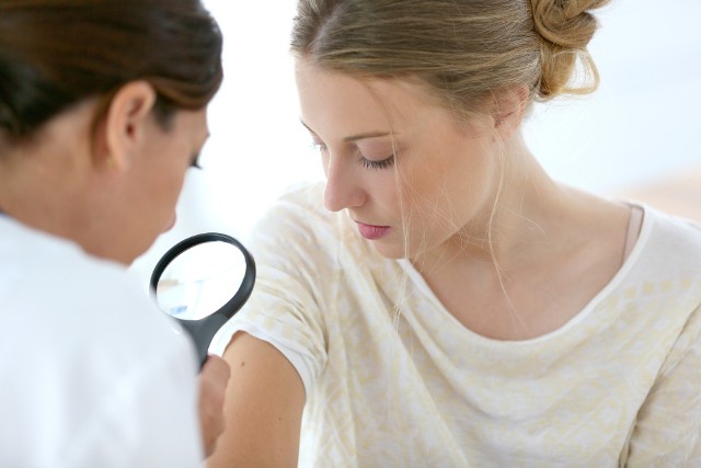 Lekarka oglądająca skórę pacjentki w ramach profilaktyki czerniaka