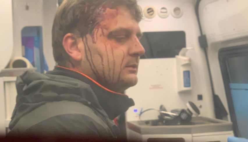 Zaatakował operatora TVP Gdańsk, ale nie zostanie tymczasowo aresztowany. Sąd nie uwzględnił wniosku prokuratury