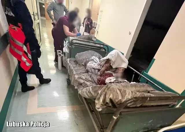 Pożar w żagańskim szpitalu objłął dwie sale
