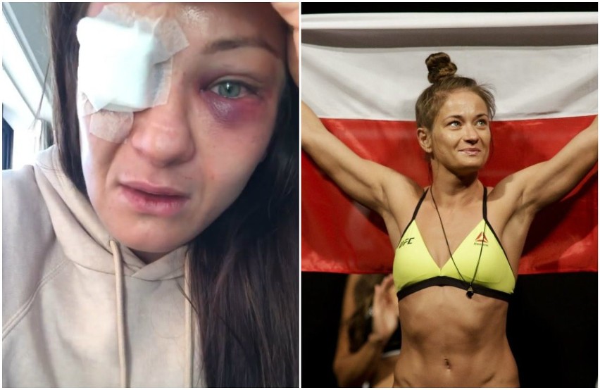 Karolina Kowalkiewicz w walce UFC doznała poważnego urazu oka. Łódzka zawodniczka MMA boi się, że straci wzrok