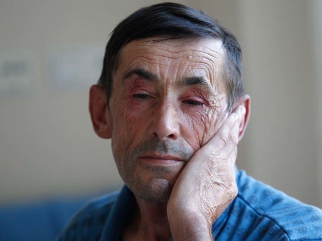Zdzisław Mroziak cudem przeżył uderzenie widłami w twarz. Nie wiadomo, czy będzie widział.