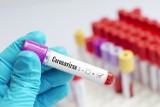 Koronawirus na Śląsku: Gwałtowny spadek nowych zakażeń. Ale są kolejne ofiary śmiertelne w szpitalach w Tychach i Raciborzu 
