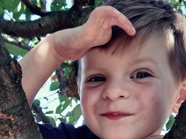 Tymek, 3-letni mieszkaniec Inowrocławia, urodził się ze zdeformowanymi rączkami i nóżkami. Tymek potrzebuje kosztownej operacji. Pomóżmy!