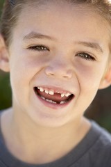 Nasze zęby mogą być zdrowe. Warunek – skrupulatna higiena