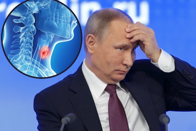 Stan zdrowia Putina – zarówno fizyczny, jak i psychiczny – wzbudza duże zainteresowanie. Co jakiś czas pojawiają się nowe doniesienia na temat chorób, które rzekomo mu dolegają.