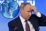 Putin miał raka tarczycy, a leczenie wywołało urojenia? Sprawdź, jakie są objawy raka tarczycy i na czym polega leczenie nowotworu