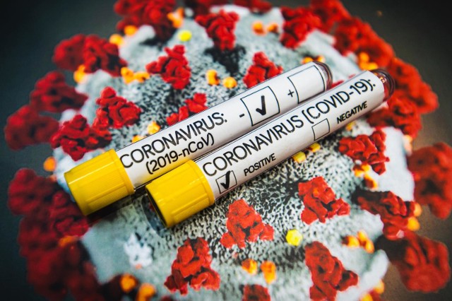 Sondaż: Polacy nie chcą obowiązkowych szczepień na koronawirusa