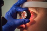 Wielka szansa dla pacjentów, którzy chcą odzyskać wzrok. Soczewka teleskopowa po raz pierwszy wszczepiona w Polsce
