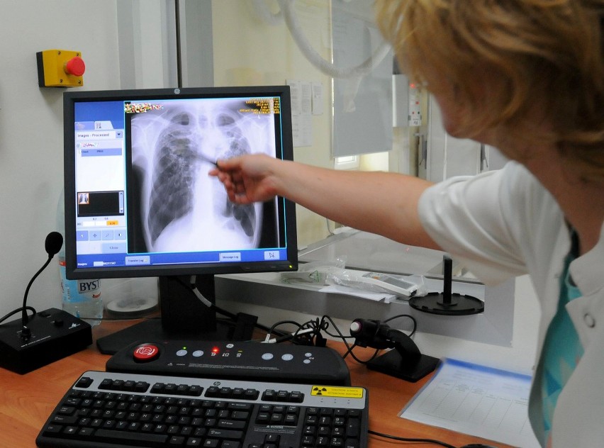 Lekarze diagnozują coraz więcej przypadków gruźlicy