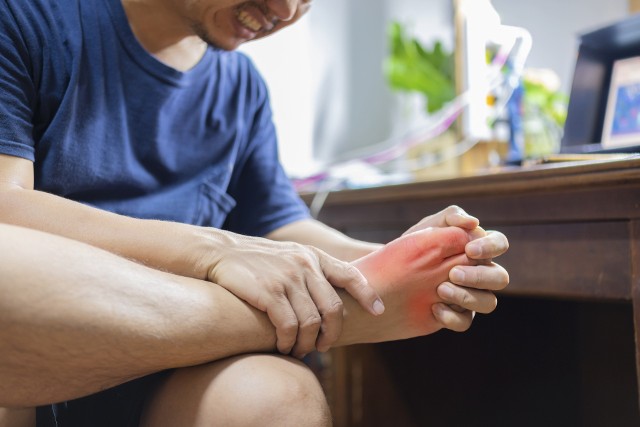 Dna moczanowa wiąże się z powstawaniem stanu zapalnego w stawach, który często rozwija się w obrębie palucha stopy.