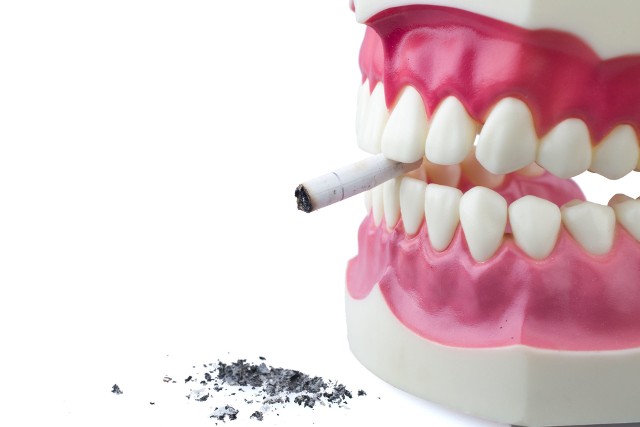 W grupie podwyższonego ryzyka rozwoju raka jamy ustnej znajdują się palacze oraz osoby regularnie przebywające w ich towarzystwie, tzw. bierni palacze.