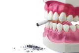 Rak jamy ustnej i jego różne odmiany. Nowotwór jamy ustnej – objawy, przyczyny i leczenie