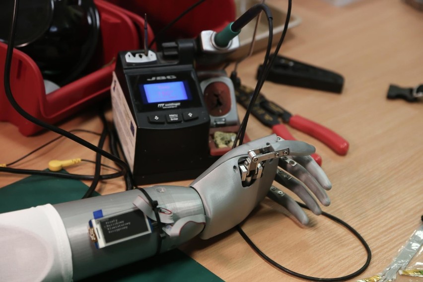Bioniczna ręka sterowana stopą wkrótce zostanie założona...