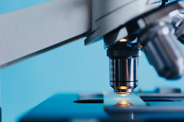 Badanie obecności szczawianu wapnia w próbce moczu wykonuje się pod mikroskopem, a wyniki podaje opisowo, określając ich poziom ich liczności.