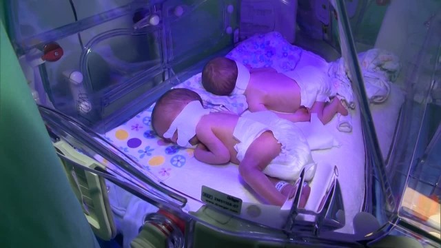 W Toruńskim Szpitalu Zespolonym 15 września na świat przyszło trzech chłopców. Jonatan, Beniamin i Stefan są trojaczkami jednojajowymi.