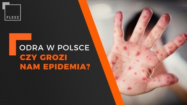 Epidemia odry w Polsce?