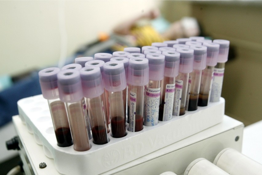 Badanie hematokrytu polega na pobraniu próbki krwi.