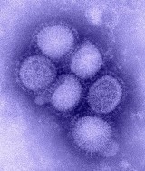 Znany jest już mechanizm jak i kogo zabija A/H1N1
