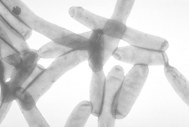 Legionella pneumophila wywołuje choroby z grupy legioneloz