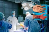 Limanowianka czyni cuda. Dr Anna Chrapusta wraz z zespołem przyszyła rękę odciętą maczetą. Mężczyzna padł ofiarą brutalnego ataku [ZDJĘCIA]