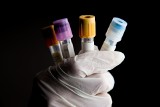 We Włoszech rozpoczęły się testy na odporność na koronawirusa
