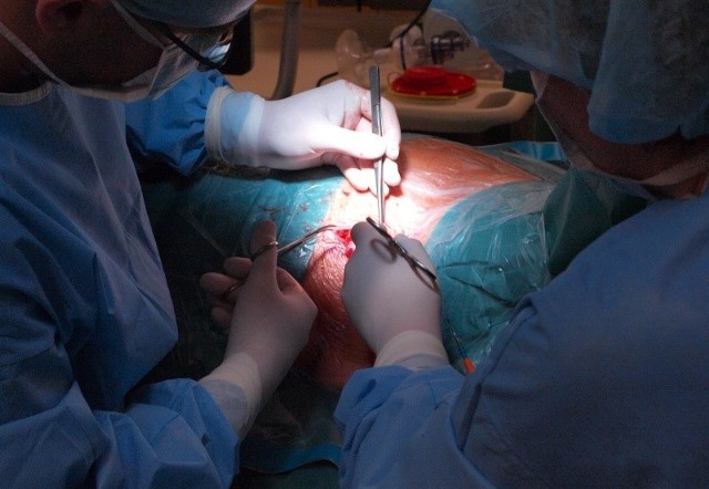 Neurochirurdzy z białostockiego szpitala klinicznego wykonają w czwartek bardzo trudną operację u rannego podczas starć na Majdanie 34-letniego Ukraińca.