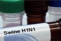 Z powodu braku szczepionki przeciwko wirusowi AH1N1 warto zaszczepić się szczepionką na grypę sezonową.
