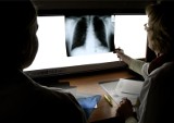Białystok. Kilkadziesiąt osób dziennie zgłasza się na rentgen płuc w pracowni przy ul. Bema. To efekt pandemii