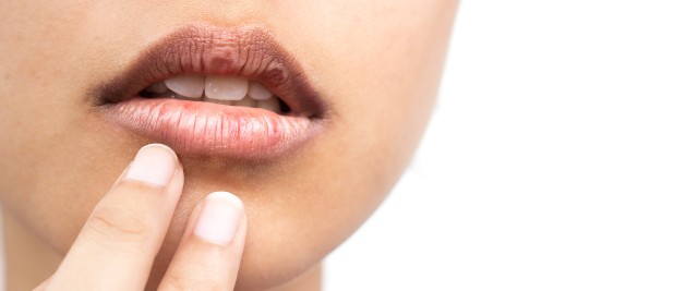 Najczęstszą przyczyną zapalenia dziąseł jest niedostateczna higiena jamy ustnej.
