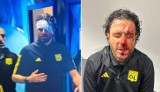 Fabio Grosso, trener Olympique Lyon, został zwolniony z klubu. Miesiąc temu był ofiarą kiboli z Marsylii