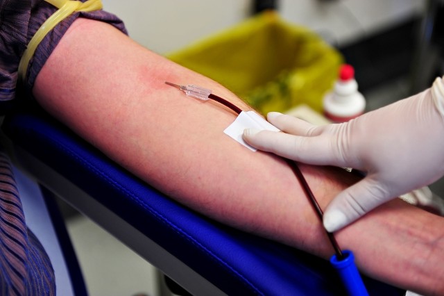 Pobieranie osocza od ozdrowieńców to bezbolesna procedura, która w nowoczesnym wydaniu wiąże się z zawróceniem do krwiobiegu dawcy oddzielonych w separatorze czerwonych i białych krwinek