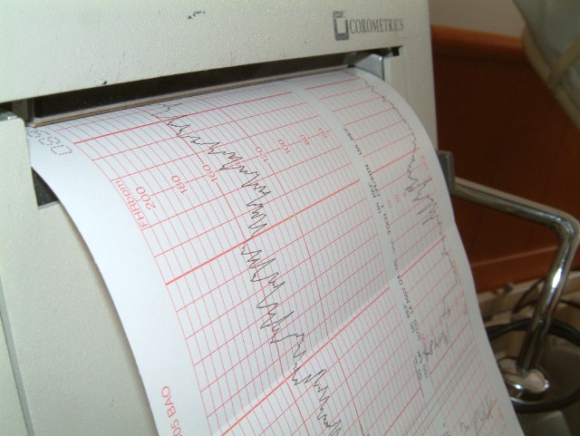 Główny Inspektor Farmaceutyczny poinformował w czwartek (15 lutego) o wycofaniu z obrotu kilku serii tabletek Oxycardil 240. To lek polecany pacjentom cierpiącym na nadciśnienie tętnicze oraz stosowany przy chorobie niedokrwiennej serca.