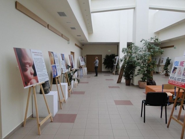 W Wyższej Szkole Nauk Społecznych i Technicznych w Radomiu otwarto wystawę "Od poczęcia jestem człowiekiem&#8221;.