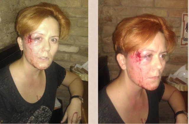 Anna Hucoł, liderka Femen, została pobita przez nieznanego mężczyznę w jednej z kijowskich kawiarni
